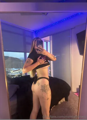 Mentltitness OnlyFans Leaked Free Thumbnail Picture - #p2iCLRpSjS