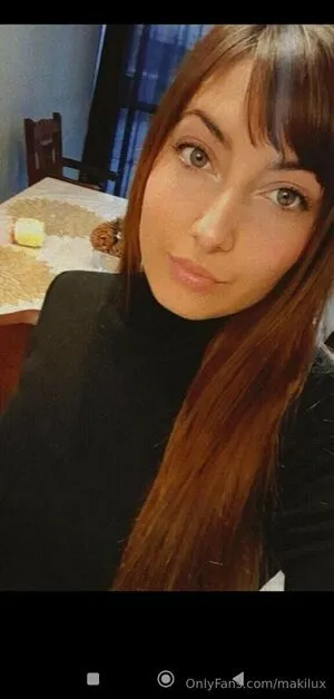Miafoxi OnlyFans Leaked Free Thumbnail Picture - #GrW0PnTOz0
