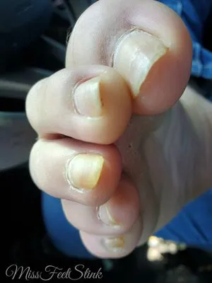 Missfeetstink OnlyFans Leaked Free Thumbnail Picture - #nElBW9Mkq2
