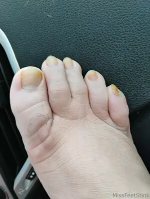 Missfeetstinkvip OnlyFans Leaked Free Thumbnail Picture - #Ldkd9xBHsO