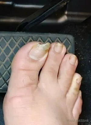 Missfeetstinkvip OnlyFans Leaked Free Thumbnail Picture - #wTAd7Koujb