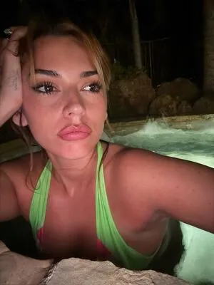 Mole OnlyFans Leaked Free Thumbnail Picture - #ysqSAKvxDj