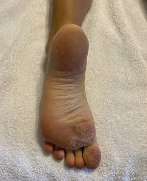 Myposedtoes OnlyFans Leaked Free Thumbnail Picture - #AD7ZEQ9kwX