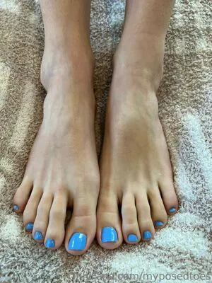 Myposedtoes OnlyFans Leaked Free Thumbnail Picture - #WrLEagy5fi