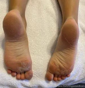 Myposedtoes OnlyFans Leaked Free Thumbnail Picture - #aIv8bSHjkp