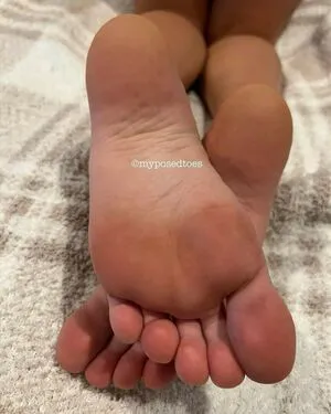 Myposedtoes OnlyFans Leaked Free Thumbnail Picture - #hKEhwVREuz