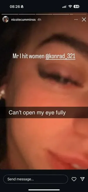 Nicolephathole OnlyFans Leaked Free Thumbnail Picture - #5ZJjEUy9BO