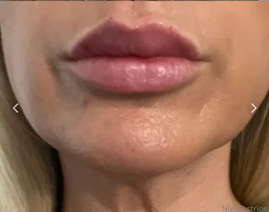 Nipsstrips OnlyFans Leaked Free Thumbnail Picture - #ywSwl0qfHD