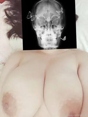Nrk Kb OnlyFans Leaked Free Thumbnail Picture - #xtwPmjIr5C