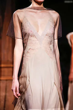 Oops Deutsch OnlyFans Leaked Free Thumbnail Picture - #YkboSu5Iep