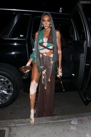 Oops International OnlyFans Leaked Free Thumbnail Picture - #3CTWsdyZXz