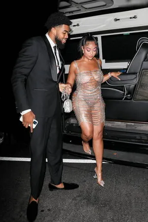 Oops International OnlyFans Leaked Free Thumbnail Picture - #50X3vLri5y