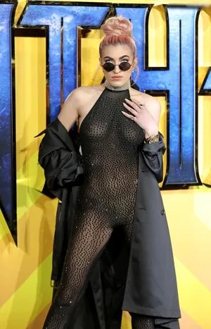 Oops International OnlyFans Leaked Free Thumbnail Picture - #7OOHZJRlRr