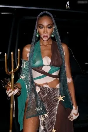 Oops International OnlyFans Leaked Free Thumbnail Picture - #8xwBiCzoaN