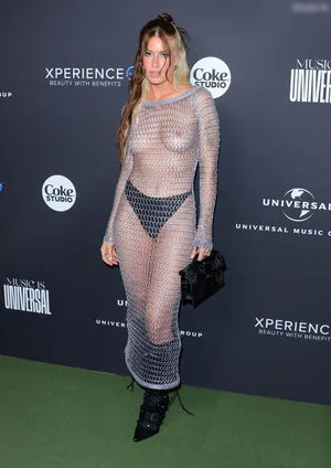 Oops International OnlyFans Leaked Free Thumbnail Picture - #Cufz2XlXeC