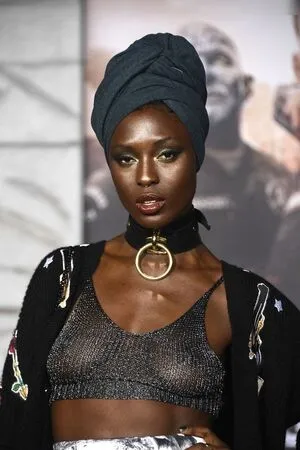 Oops International OnlyFans Leaked Free Thumbnail Picture - #DOGhpf2h9s