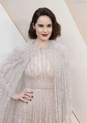 Oops International OnlyFans Leaked Free Thumbnail Picture - #I2Usff2A7s