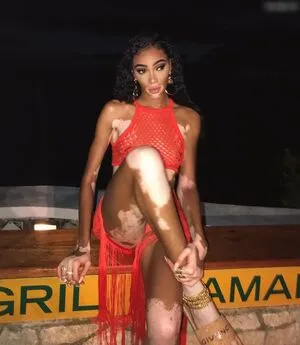 Oops International OnlyFans Leaked Free Thumbnail Picture - #JRqI54VeBA