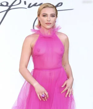 Oops International OnlyFans Leaked Free Thumbnail Picture - #JhixN83OCo