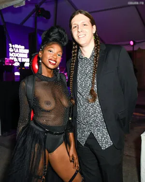 Oops International OnlyFans Leaked Free Thumbnail Picture - #KH3jpblX5t