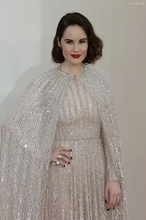 Oops International OnlyFans Leaked Free Thumbnail Picture - #NEkUiqJ19e