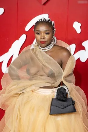 Oops International OnlyFans Leaked Free Thumbnail Picture - #Sj8V0g2AZ9