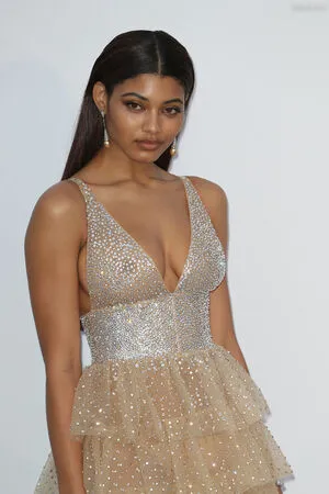 Oops International OnlyFans Leaked Free Thumbnail Picture - #WFMFKXGGPw