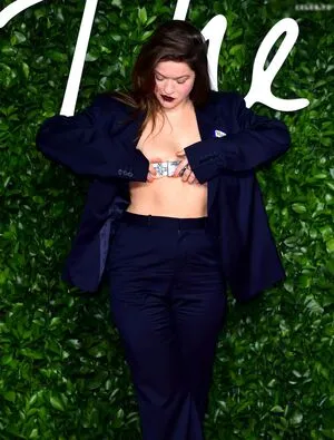 Oops International OnlyFans Leaked Free Thumbnail Picture - #ZR2xY8AmfC