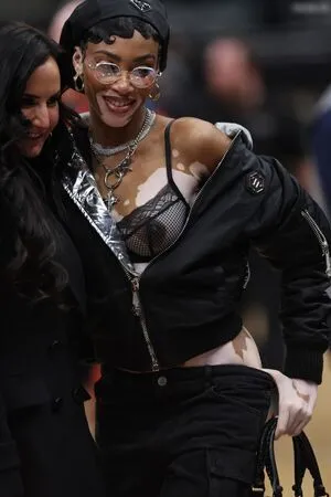 Oops International OnlyFans Leaked Free Thumbnail Picture - #ZWKkcpwJmk