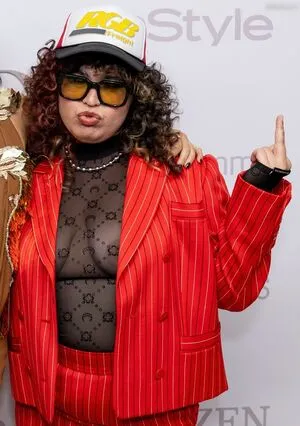 Oops International OnlyFans Leaked Free Thumbnail Picture - #ckO1rmoInC