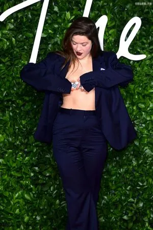 Oops International OnlyFans Leaked Free Thumbnail Picture - #f0oskI38Ok