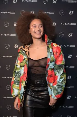 Oops International OnlyFans Leaked Free Thumbnail Picture - #gruQ7qg67C