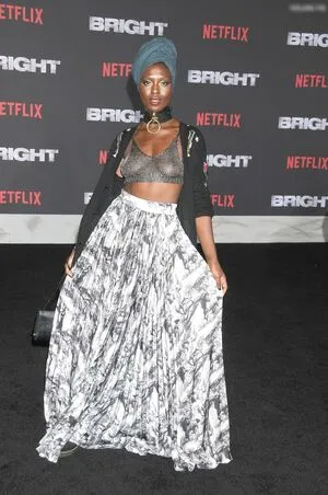 Oops International OnlyFans Leaked Free Thumbnail Picture - #hbYlDk37J4