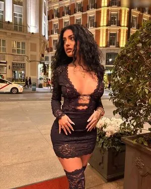 Oops International OnlyFans Leaked Free Thumbnail Picture - #jP3ARo6ZS9