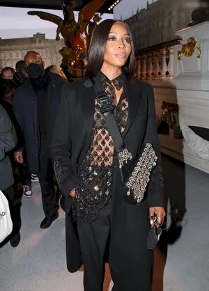 Oops International OnlyFans Leaked Free Thumbnail Picture - #sTyYD0nTfi