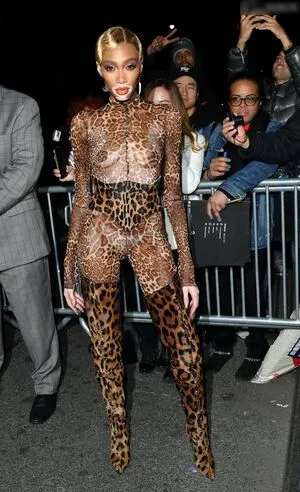 Oops International OnlyFans Leaked Free Thumbnail Picture - #snv1Prmnkq