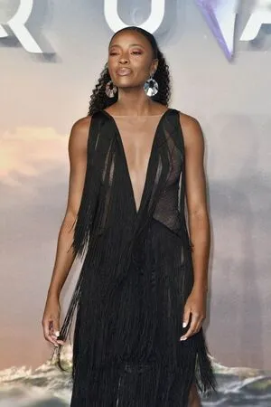 Oops International OnlyFans Leaked Free Thumbnail Picture - #v8UD0NjinY