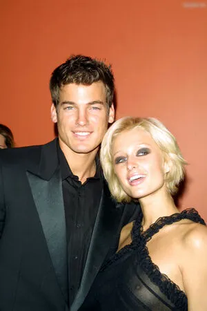 Oops International OnlyFans Leaked Free Thumbnail Picture - #ygU42VXCkE