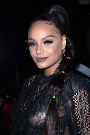 Oops International OnlyFans Leaked Free Thumbnail Picture - #ysBWah0sOD