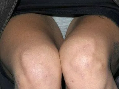 Peaches Geldof OnlyFans Leaked Free Thumbnail Picture - #VQyIueJpwT