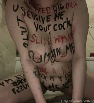 Poorthing OnlyFans Leaked Free Thumbnail Picture - #96qeORTdRb
