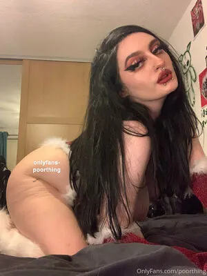 Poorthing OnlyFans Leaked Free Thumbnail Picture - #p49hHlExtg