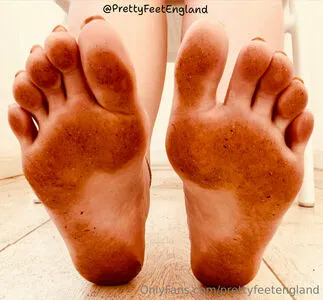 Prettyfeetengland OnlyFans Leaked Free Thumbnail Picture - #6l4RzXhnDi