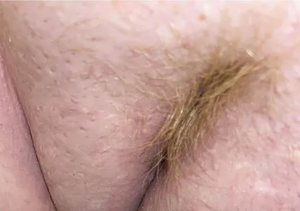 Rachel000 OnlyFans Leaked Free Thumbnail Picture - #K9tusmsgPr