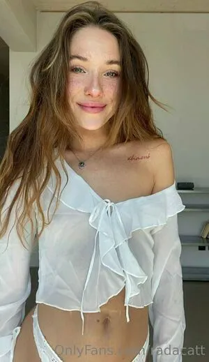 Radacatt OnlyFans Leaked Free Thumbnail Picture - #1S4BGHbb68