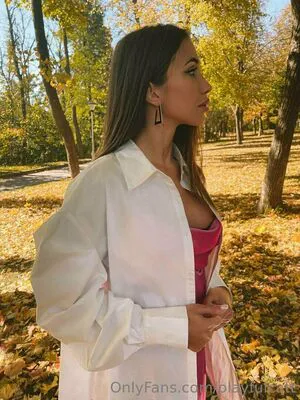 Radacatt OnlyFans Leaked Free Thumbnail Picture - #wDDmJ0n9Ov