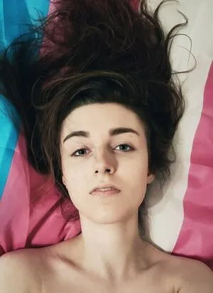 Raddles OnlyFans Leaked Free Thumbnail Picture - #kbr1MuU2om