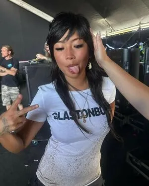 Radvxz OnlyFans Leaked Free Thumbnail Picture - #1Eik3vTZBM