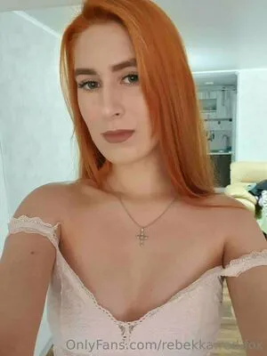 Rebekka Red Fox OnlyFans Leaked Free Thumbnail Picture - #Xm7yCWPQzQ