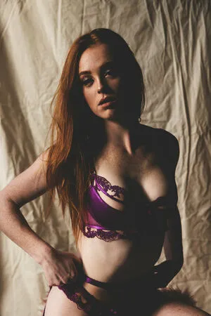 Redalertfox OnlyFans Leaked Free Thumbnail Picture - #ZQMHHgj5rD